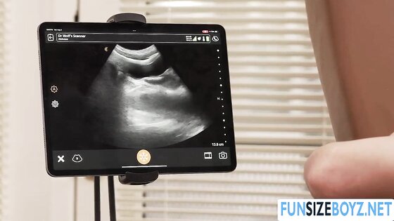 Fucking my well patient in his tight ass