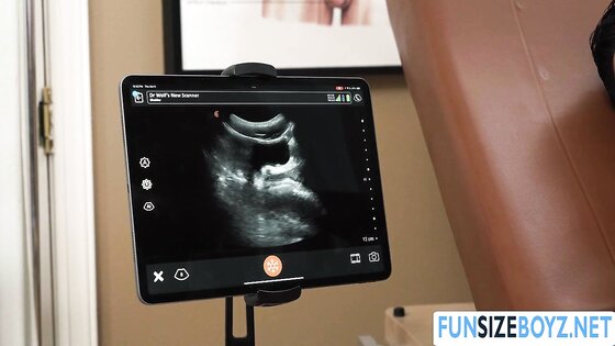 Watching my doctors dick inside my ass in monitor